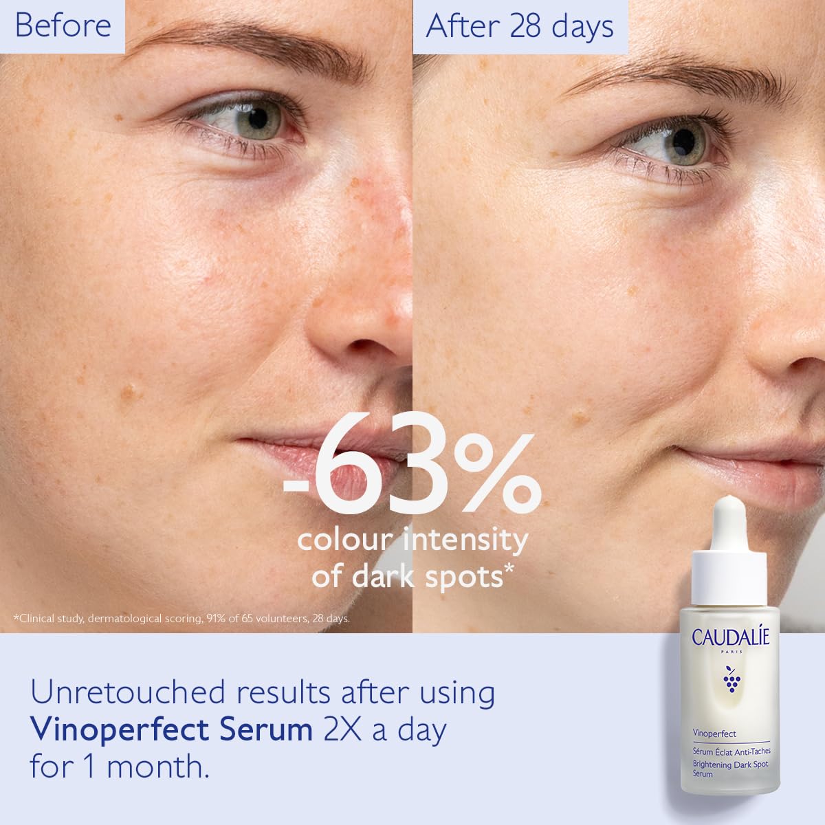 Caudalie Vinoperfect Brightening Dark Spot Serum Vitamin C Alternative